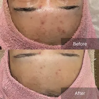 Iryアイリー所属・Iry アイリーのエステ・リラクイメージ