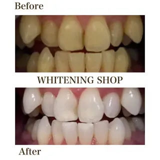 ホワイトニング ショップ川越店のエステ・リラクイメージ