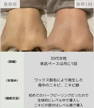 脱毛・眉毛・フェイス サロンN久留米店の眉毛・アイブロウイメージ