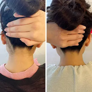 うなじ脱毛/美肌脱毛 LABELのエステ・リラクイメージ