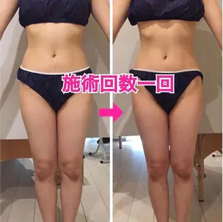 ロング カラー パーマ ヘアアレンジ メンズ キッズ ネイル マツエク・マツパ ‍痩身＆ボディ 結果出し🌟丹野のエステ・リラクイメージ