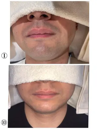 メンズ Beauty Salon Charmant所属・富山 千晶のエステ・リラクイメージ