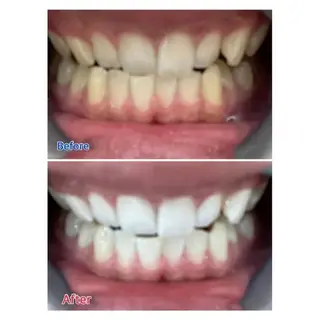 M渋谷店所属・M渋谷 ホワイトニングのエステ・リラクイメージ