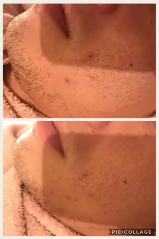 セミロング カラー パーマ ヘアアレンジ メンズ キッズ ネイル マツエク・マツパ 四つ星サロン🎖 腸＆ニキビケアに特化のエステ・リラクイメージ