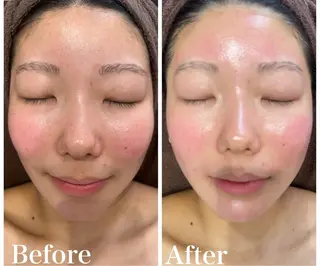 LAKI eye&face  studio所属・LAKI studioのエステ・リラクイメージ