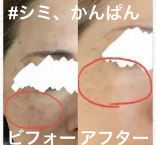 ハーブピーリング専門 COCO.梅田中津のエステ・リラクイメージ