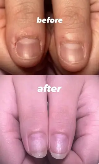 メンズ ネイル 爪ケア/深爪 自爪育成 🐰えむのネイルデザイン