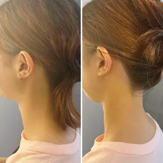 うなじ脱毛/美肌脱毛 LABELのエステ・リラクイメージ