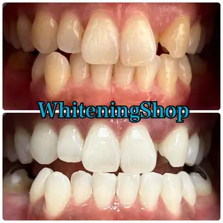 ホワイトニング ショップ吉祥寺店のエステ・リラクイメージ