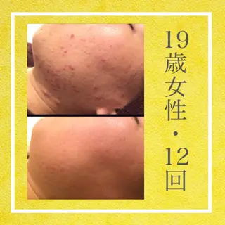 ミディアム カラー パーマ ヘアアレンジ メンズ キッズ ネイル マツエク・マツパ ニキビ・肌質改善専門 ♡人生が変わるサロンのエステ・リラクイメージ