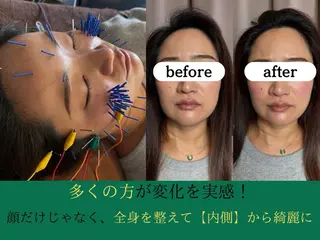 まつもと美容鍼灸整体サロン所属・松本 翔太のエステ・リラクイメージ