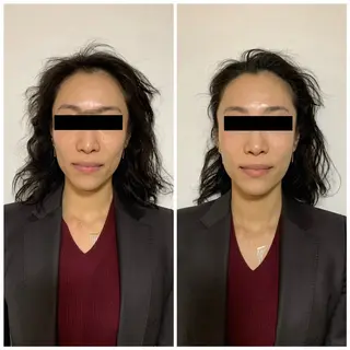 ショート LUCIALL  ルシアル所属・児玉 愛由美のエステ・リラクイメージ