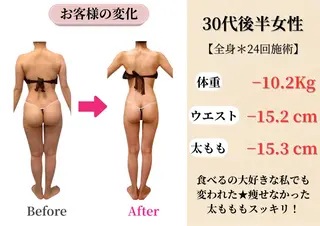 Belle White所属・本格痩身＊肌質改善＊ BelleWhiteのエステ・リラクイメージ