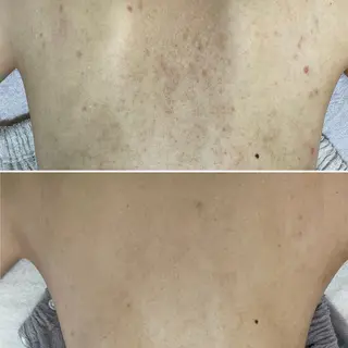 シェノン所属・ニキビ・毛穴・ フェイシャル専門店のその他イメージ