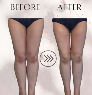 綺麗のひみつ グランプリ受賞店のエステ・リラクイメージ