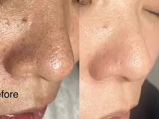 mone~total care salon~所属・mone (モーネ)のエステ・リラクイメージ