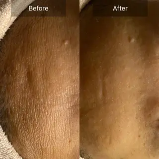 Mandarin Orange所属・毛穴から始める肌メン テマンダリンオレンジのエステ・リラクイメージ