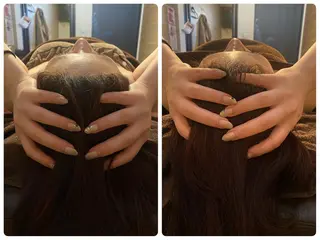 ハーブピーリング🌿 脱毛🧡ヘッドスパのエステ・リラクイメージ