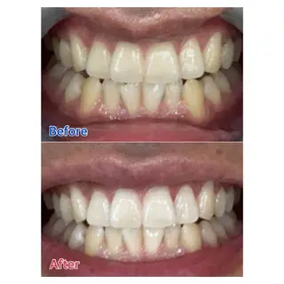 MBEAUTYSALON 千葉店・京成大久保所属・Melty 輝のその他イメージ