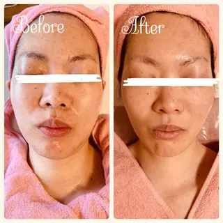 透明感の肌Lino malieのエステ・リラクイメージ