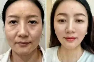 ネイル aliaハイフ&水光ジェットサロン所属・aliaハーブ水光店 エステティシャン募集のエステ・リラクイメージ