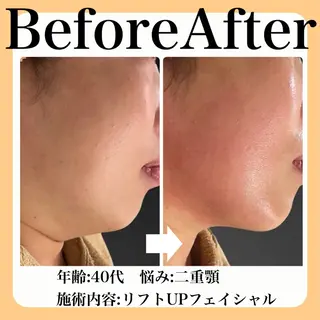 毛穴・たるみ･ニキビケア専門サロンsui所属・sui【スイ】 ARISAのエステ・リラクイメージ