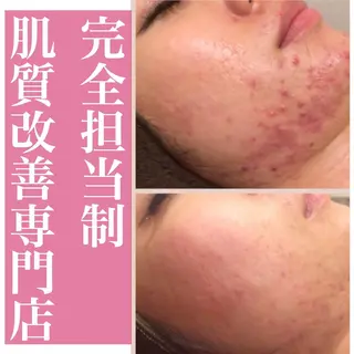 ミディアム カラー パーマ ヘアアレンジ メンズ キッズ ネイル マツエク・マツパ ニキビ・肌質改善専門 ♡人生が変わるサロンのエステ・リラクイメージ