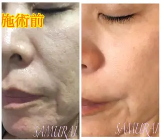 メンズ メンズ専用サロンSAMURAI所属・YAMASHITA HIROKOのエステ・リラクイメージ