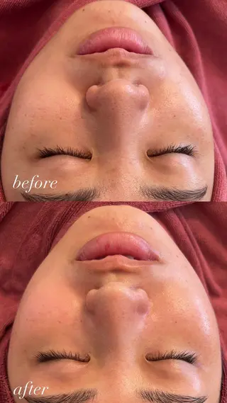 肌管理サロン neoriiのその他イメージ