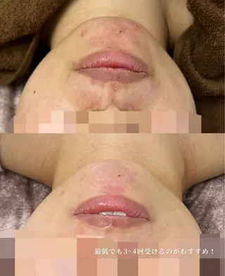 看護師が施術する ナスサロ/Emi🪽のエステ・リラクイメージ