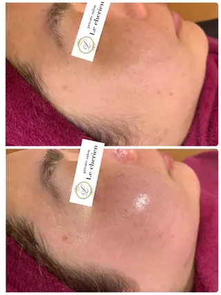 Le cherien所属・Le cherien ルシェリアのエステ・リラクイメージ