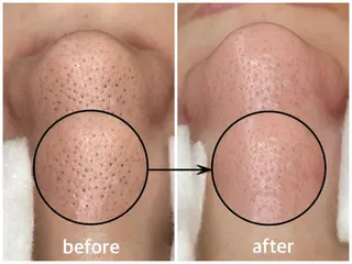 韓国肌管理 【毛穴専科】のエステ・リラクイメージ