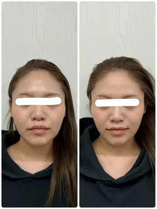 美容鍼×小顔矯正 ×美容整体　浜川泰仁のエステ・リラクイメージ