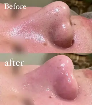 HINA/産毛脱毛・ 肌質改善専門サロンのエステ・リラクイメージ