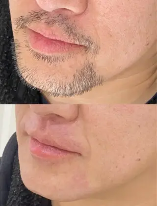 Salon de Galcon 2階(サロンド・ギャルソン)所属・KU TA  \(◡̈)/のエステ・リラクイメージ