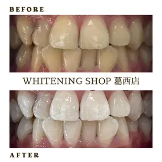 メンズ ホワイトニング ショップ葛西店のその他イメージ