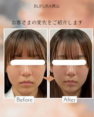 小顔矯正＆美肌サロン BUPURA岡山のエステ・リラクイメージ