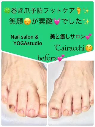 ネイル Tairacchi ﾀｲﾗｯﾁのエステ・リラクイメージ