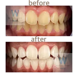 ホワイトニング ショップ船橋２号店のエステ・リラクイメージ