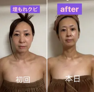 透明感の肌Lino malieのエステ・リラクイメージ