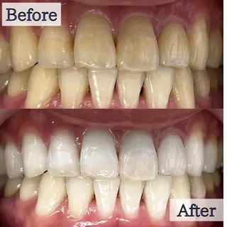 LBSホワイトニング 🌐渋谷店 小河原のエステ・リラクイメージ