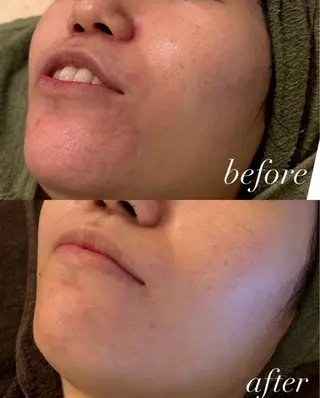 Ellebeauty relaxationのエステ・リラクイメージ