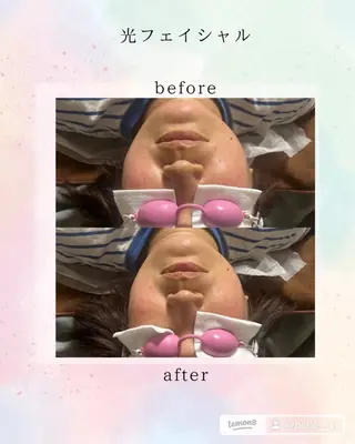 Belle ＋vi（ベル）のその他イメージ