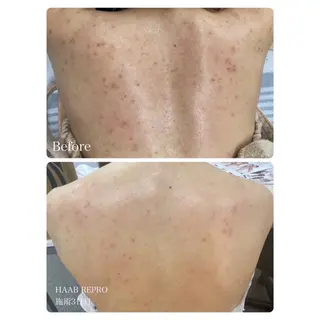 肌管理サロン neoriiのその他イメージ