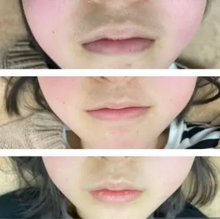 キッズ RE:moom リムーム/脱毛エステのエステ・リラクイメージ