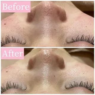 ハーブピーリング専門 muro.のエステ・リラクイメージ