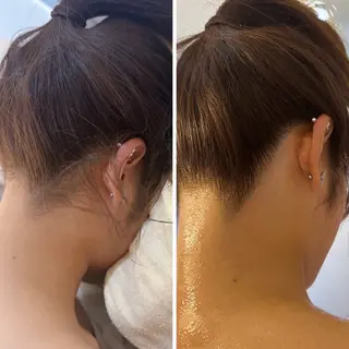 うなじ脱毛/美肌脱毛 LABELのエステ・リラクイメージ