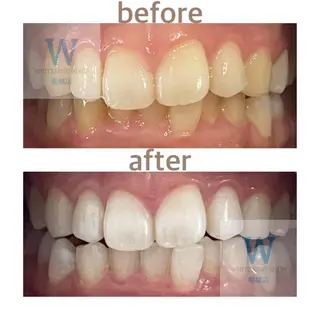 ホワイトニング ショップ船橋店🦷のエステ・リラクイメージ