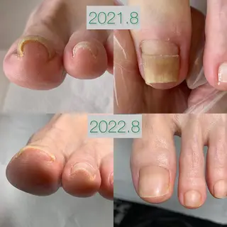 ネイル Takasaki Keikoのネイルデザイン