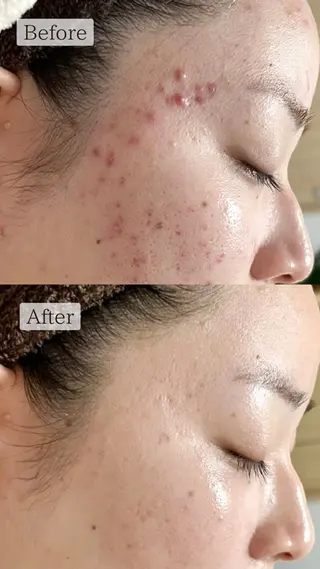 肌質改善専門サロン Bellmi/心斎橋のエステ・リラクイメージ